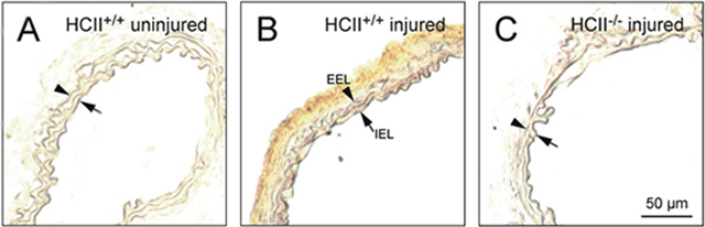 HCII binds to dermatan sulfate in the arterial wall after endothelial injury