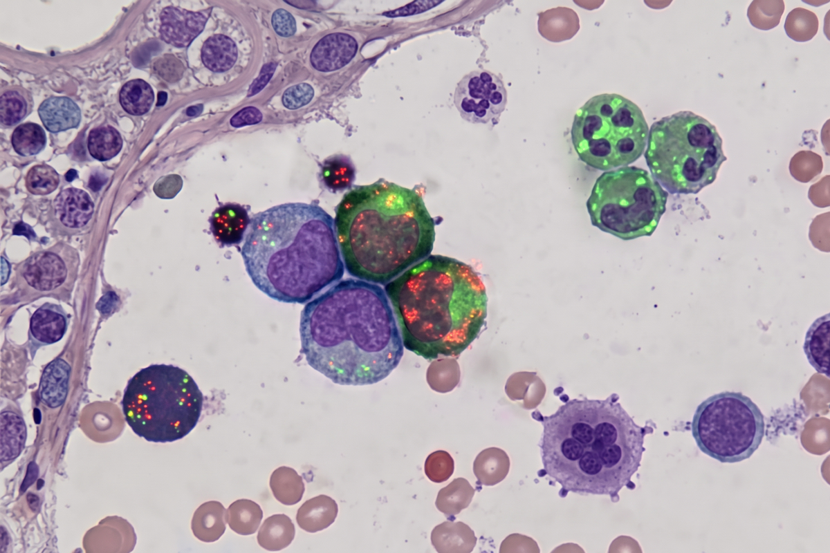 Study Reveals How UPR Signaling Regulates Blood Cell Output in Health and Cancer