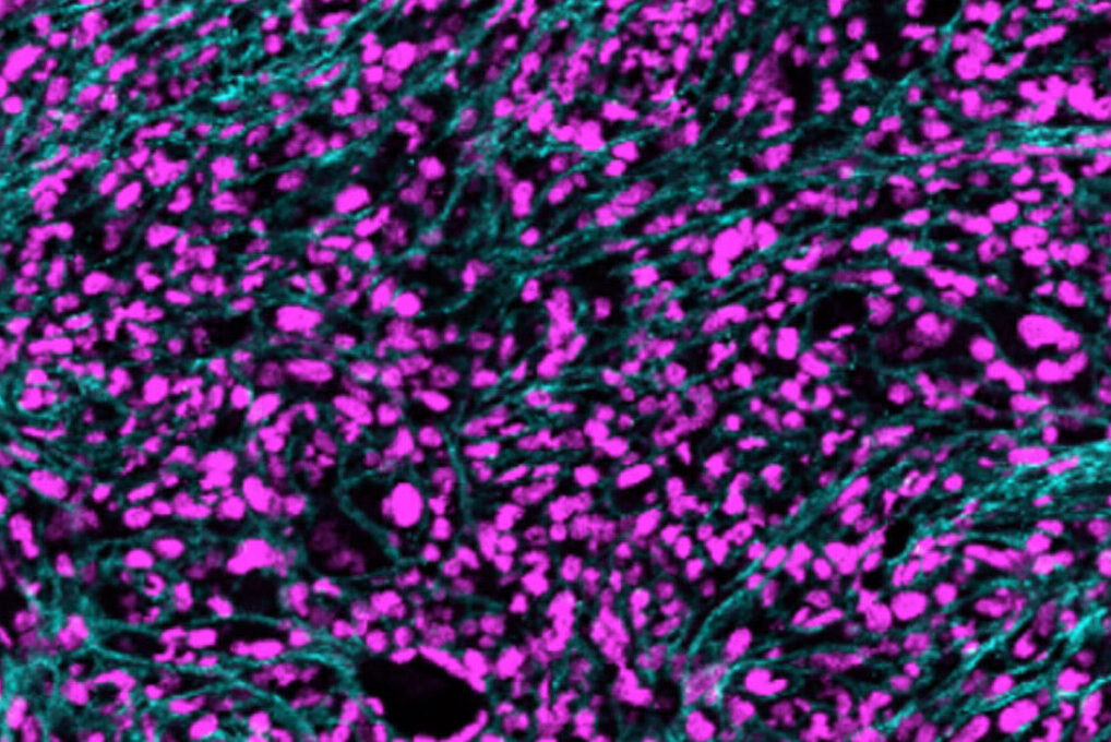 $11.7 million from NIH supports research on inflammation in blood cancers
